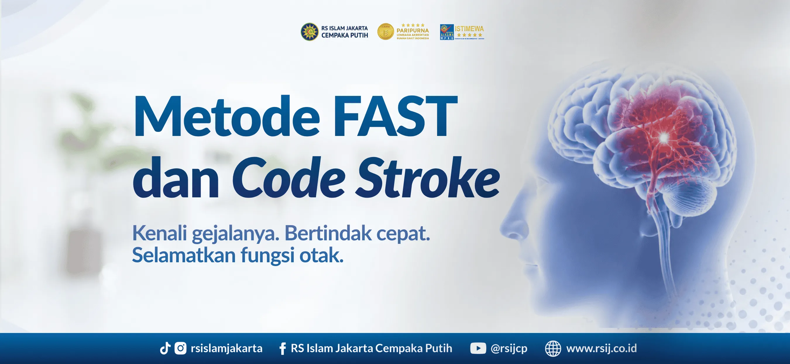 Metode FAST dan Code Stroke: Selamatkan Fungsi Otak dengan Penanganan Cepat Stroke